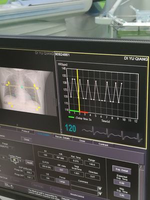 兴化市人民医院东芝640层CT Aquilion Vision正式投入使用